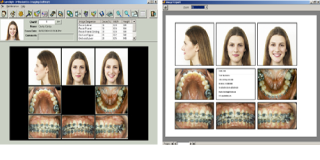 Ortho Imaging Software