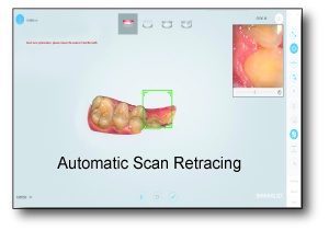 3D Intraoral Scanner